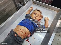 tornup_gaza_child.jpeg